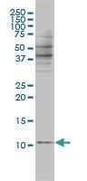 Anti-BANF1 Mouse monoclonal antibody unconjugated [clone: 3F10-4G12]