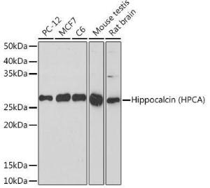 Western blot analysis of extracts of various cell lines, using Anti-Hippocalcin Antibody [ARC2235] (A307363) at 1:1,000 dilution. The secondary antibody was Goat Anti-Rabbit IgG H&L Antibody (HRP) at 1:10,000 dilution.