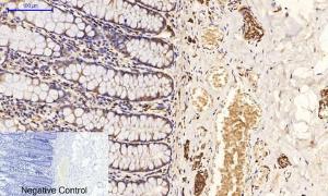 Immunohistochemical analysis of paraffin-embedded human colon tissue using Anti-Tau (phospho Ser396) Antibody at 1:200 (4 °C overnight). Negative control was secondary Antibody only