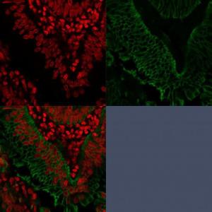 Antibody anti-epcam EGP401372 100 µg