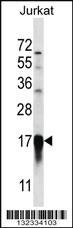 Anti-PFDN5 Rabbit Polyclonal Antibody