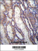 Anti-FOXA2 Rabbit Polyclonal Antibody (FITC (Fluorescein Isothiocyanate))