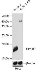 Western blot analysis of extracts from normal (control) and HPCAL1 knockout (KO) HeLa cells, using Anti-VILIP3 Antibody (A307364) at 1:1000 dilution. The secondary Antibody was Goat Anti-Rabbit IgG H&L Antibody (HRP) at 1:10000 dilution. Lysates/proteins were present at 25 µg per lane