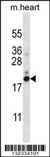 Anti-PFDN5 Rabbit Polyclonal Antibody