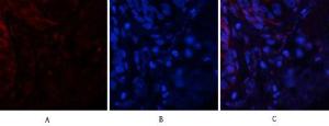 Immunofluorescence analysis of human lung tissue using Anti-Tau (phospho Ser396) Antibody (red) at 1:200 (4 °C overnight). Cy3 labelled secondary Antibody was used at 1:300 (RT 50 min). Panel A: Target. Panel B: DAPI. Panel C: Merge