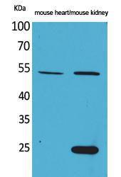 Western blot analysis of mouse heart, mouse kidney cells using Anti-SCG3 Antibody