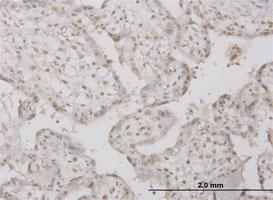 Anti-PPP1R2 Mouse Monoclonal Antibody [clone: 2E9]