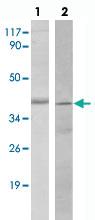 Anti-SIRT2 Rabbit Polyclonal Antibody