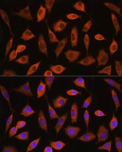 Immunofluorescence analysis of L929 cells using Anti-eIF2B4 Antibody (A305759) at a dilution of 1:100. DAPI was used to stain the cell nuclei (blue).