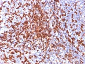 Immunohistochemical analysis of formalin-fixed, paraffin-embedded human tonsil using Anti-CD44 Antibody [156-3C11]