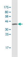 Anti-ZNF154 Mouse Monoclonal Antibody [clone: 6G11]