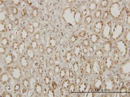 Anti-EXOSC3 Mouse Monoclonal Antibody [clone: 5C3]