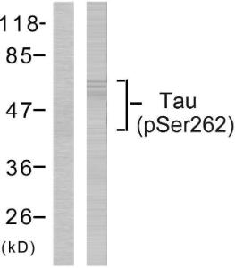 Western blot analysis of lysates from HeLa cells using Anti-Tau (phospho Ser262) Antibody. The left hand lane represents a negative control, where the Antibody is blocked by the immunising peptide