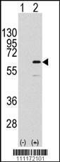 Anti-ELK1 Rabbit Polyclonal Antibody (PE (Phycoerythrin))