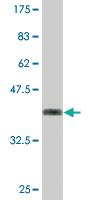 Anti-CBFA2T2 Mouse Monoclonal Antibody [clone: 3A2]