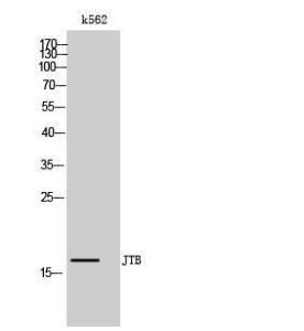 Western blot analysis of k562 cells using Anti-JTB Antibody