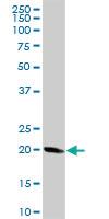 Anti-STMN1 Rabbit Polyclonal Antibody