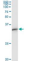 Anti-EXOSC3 Mouse Monoclonal Antibody [clone: 5C3]