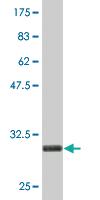 Anti-ST13 Mouse Monoclonal Antibody [clone: 2B2]