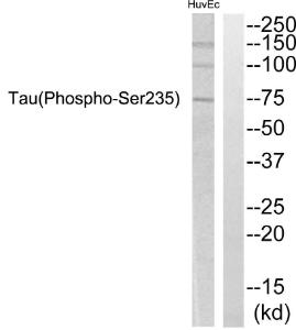 Western blot analysis of lysates from HUVEC cells using Anti-Tau (phospho Ser235) Antibody. The right hand lane represents a negative control, where the antibody is blocked by the immunising peptide