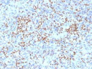 Immunohistochemical analysis of formalin-fixed, paraffin-embedded human spleen using Anti-PU.1 Antibody [PU1/2146]