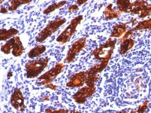 Immunohistochemical analysis of formalin-fixed, paraffin-embedded human thyroid using Anti-Thyroglobulin Antibody [2H11]