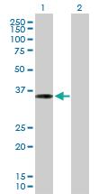 Anti-PPP1R3C Mouse Polyclonal Antibody