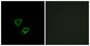 Immunofluorescence analysis of A549 cells using Anti-ZNRF2 Antibody. The right hand panel represents a negative control, where the antibody was pre-incubated with the immunising peptide