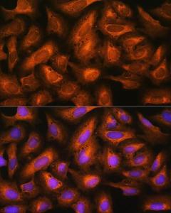 Immunofluorescence analysis of U2OS cells using Anti-eIF2B4 Antibody (A305759) at a dilution of 1:100. DAPI was used to stain the cell nuclei (blue).