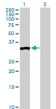 Anti-PPP1R3C Rabbit Polyclonal Antibody