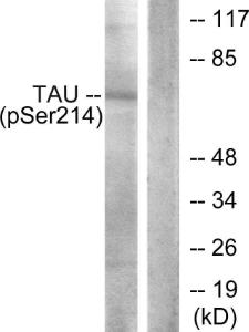 Anti-Tau