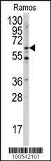 Anti-CSNK2A2 Rabbit Polyclonal Antibody