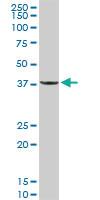 Anti-PPP1R3C Rabbit Polyclonal Antibody