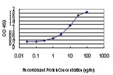 Anti-EXOSC3 Mouse Monoclonal Antibody [clone: 5C3]