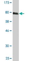 Anti-STK38 Mouse Monoclonal Antibody [clone: 2G8-1F3]