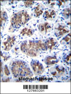 Anti-TMEM18 Rabbit Polyclonal Antibody (HRP (Horseradish Peroxidase))