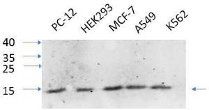 Western blot analysis of various cells using Anti-IL8 Antibody at 1:1,000 (4°C overnight). Goat Anti-Rabbit IgG (IRDye 800) was used as a secondary at 1:5,000 (25°C, 1 hour).