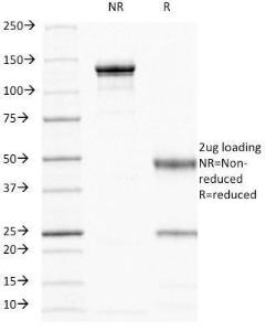 SDS-PAGE analysis of Anti-CD44 Antibody [156-3C11] under non-reduced and reduced conditions; showing intact IgG and intact heavy and light chains, respectively. SDS-PAGE analysis confirms the integrity and purity of the antibody.