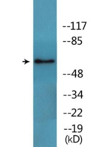 Western blot analysis of lysates from Jurkat cells treated with EGF 200ng/ml 5' using Anti-Src (phospho Tyr216) Antibody