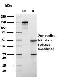 SDS-PAGE analysis of Anti-HER2 Antibody [ERBB2/3078] under non-reduced and reduced conditions; showing intact IgG and intact heavy and light chains, respectively. SDS-PAGE analysis confirms the integrity and purity of the antibody