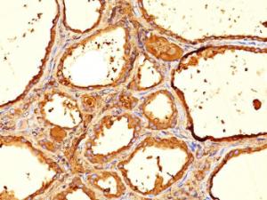 Immunohistochemical analysis of formalin-fixed, paraffin-embedded human thyroid using Anti-Thyroglobulin Antibody [6E1]