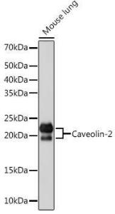 Western blot analysis of extracts of Mouse lung, using Anti-Caveolin-2 Antibody [ARC0323] (A307368) at 1:1,000 dilution. The secondary antibody was Goat Anti-Rabbit IgG H&L Antibody (HRP) at 1:10,000 dilution.