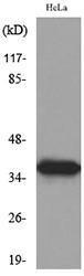 Antibody anti-ANXA2 100 µg