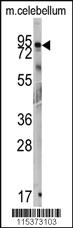 Anti-NADK2 Rabbit Polyclonal Antibody