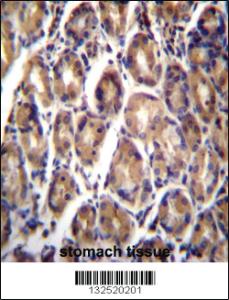 Anti-RARRES1 Rabbit Polyclonal Antibody