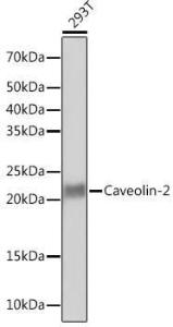 Western blot analysis of extracts of 293T cells, using Anti-Caveolin-2 Antibody [ARC0323] (A307368) at 1:1,000 dilution. The secondary antibody was Goat Anti-Rabbit IgG H&L Antibody (HRP) at 1:10,000 dilution.