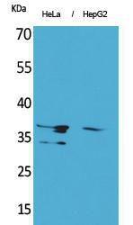 Antibody anti-ANXA2 100 µg