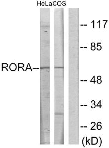 Western blot analysis of lysates from HeLa and COS7 cells using Anti-RORA Antibody. The right hand lane represents a negative control, where the antibody is blocked by the immunising peptide