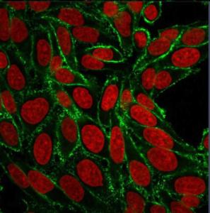 Immunofluorescent analysis of HeLa cells stained with Anti-CD44 Antibody [156-3C11] (CF&#174; 488) (Green). Nuclear counterstain is RedDot.