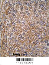 Anti-NADK2 Rabbit Polyclonal Antibody